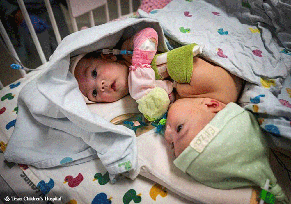 Texas Childrens Hospital, Ella Grace and Eliza Faith Fuller - Texas Hospital Association Texas Childrens Hospital, Ella Grace and Eliza Faith Fuller